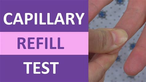 how to chart capillary refill